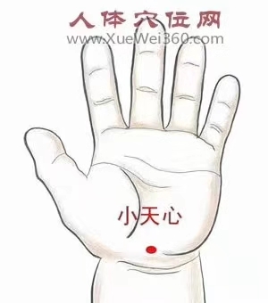 picname